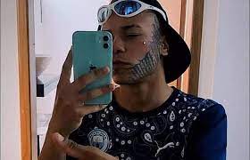 Adolescente brasileña se somete a procedimiento para eliminar tatuaje que  su exnovio tatuó en su rostro