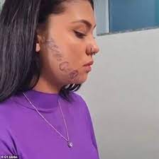 Adolescente brasileña se somete a procedimiento para eliminar tatuaje que  su exnovio tatuó en su rostro