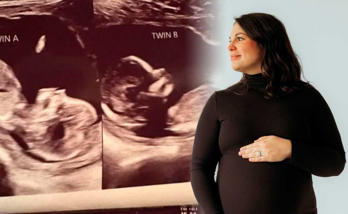 mujer-nacio-dos-uteros-quedo-embarazada-ambos