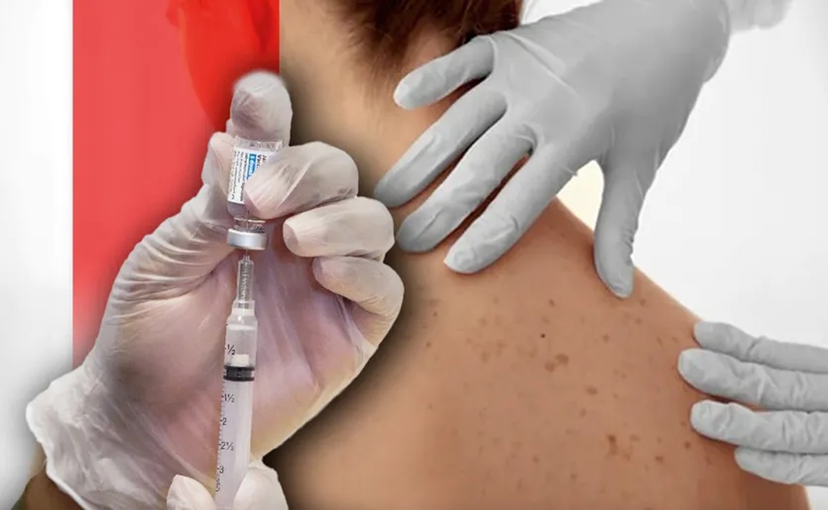 vacuna-contra-cancer-de-piel-disponible-2025