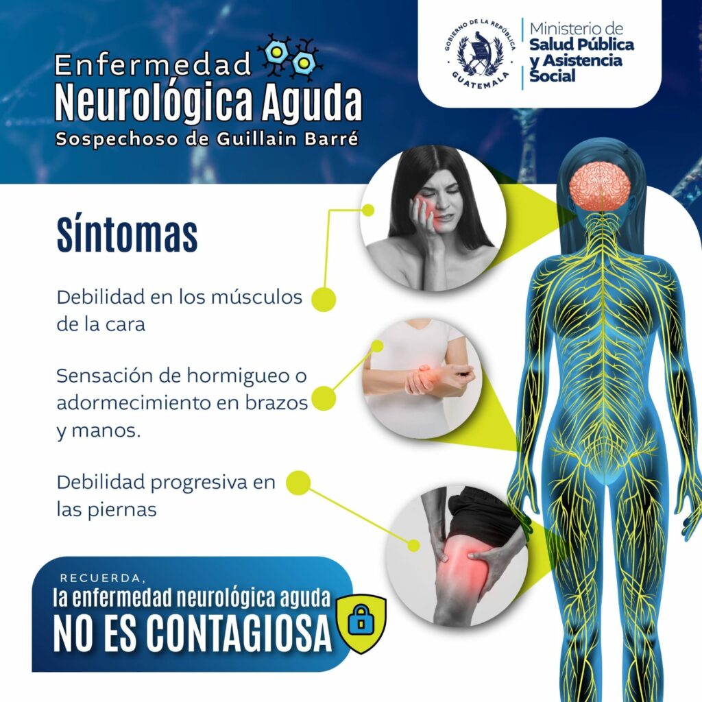 Síntomas del síndrome de Guillain-Barré en Guatemala